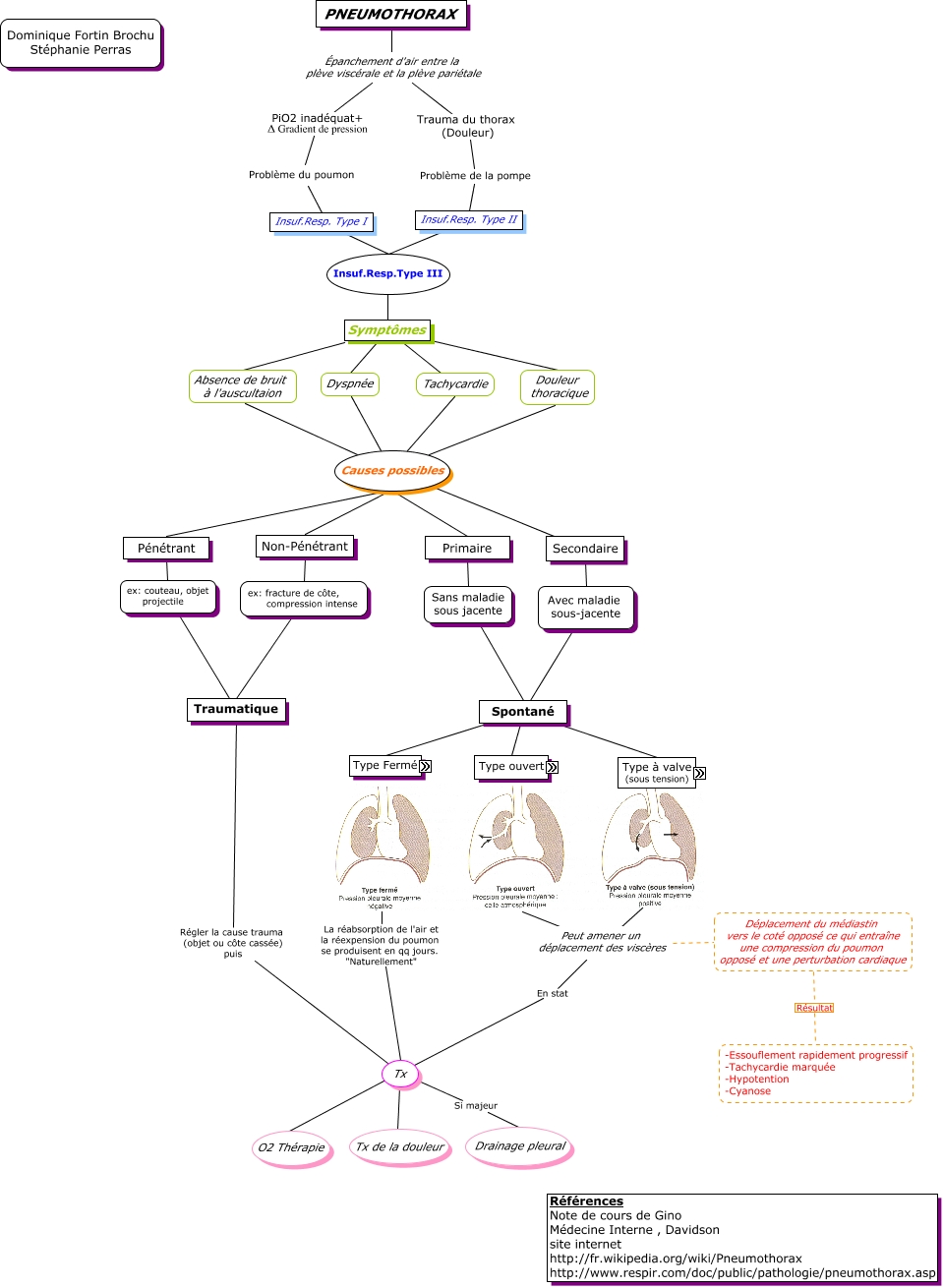 pneumothorax.Steph_Doom