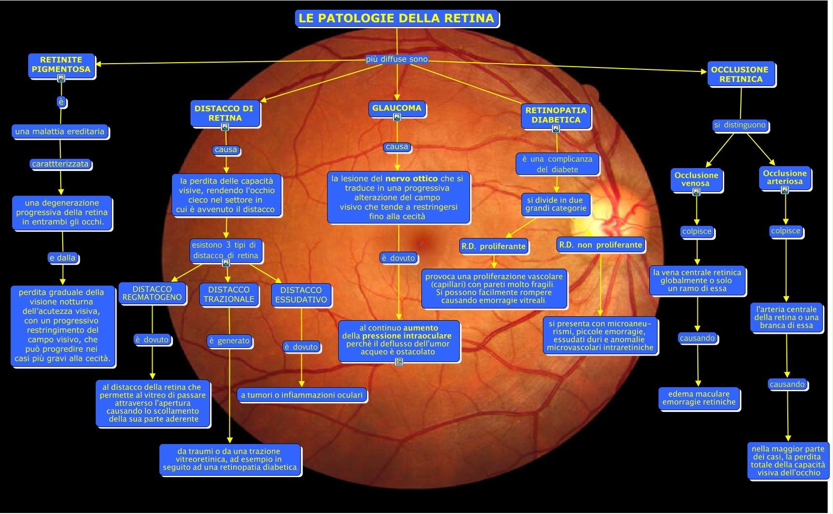 Le patologie della retina